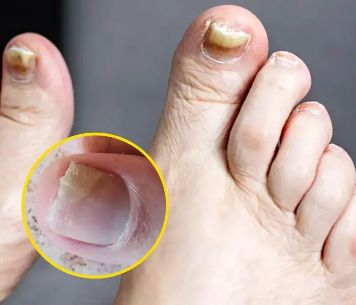 Watch for these 5 signs in your feet - they may point to a serious health issue