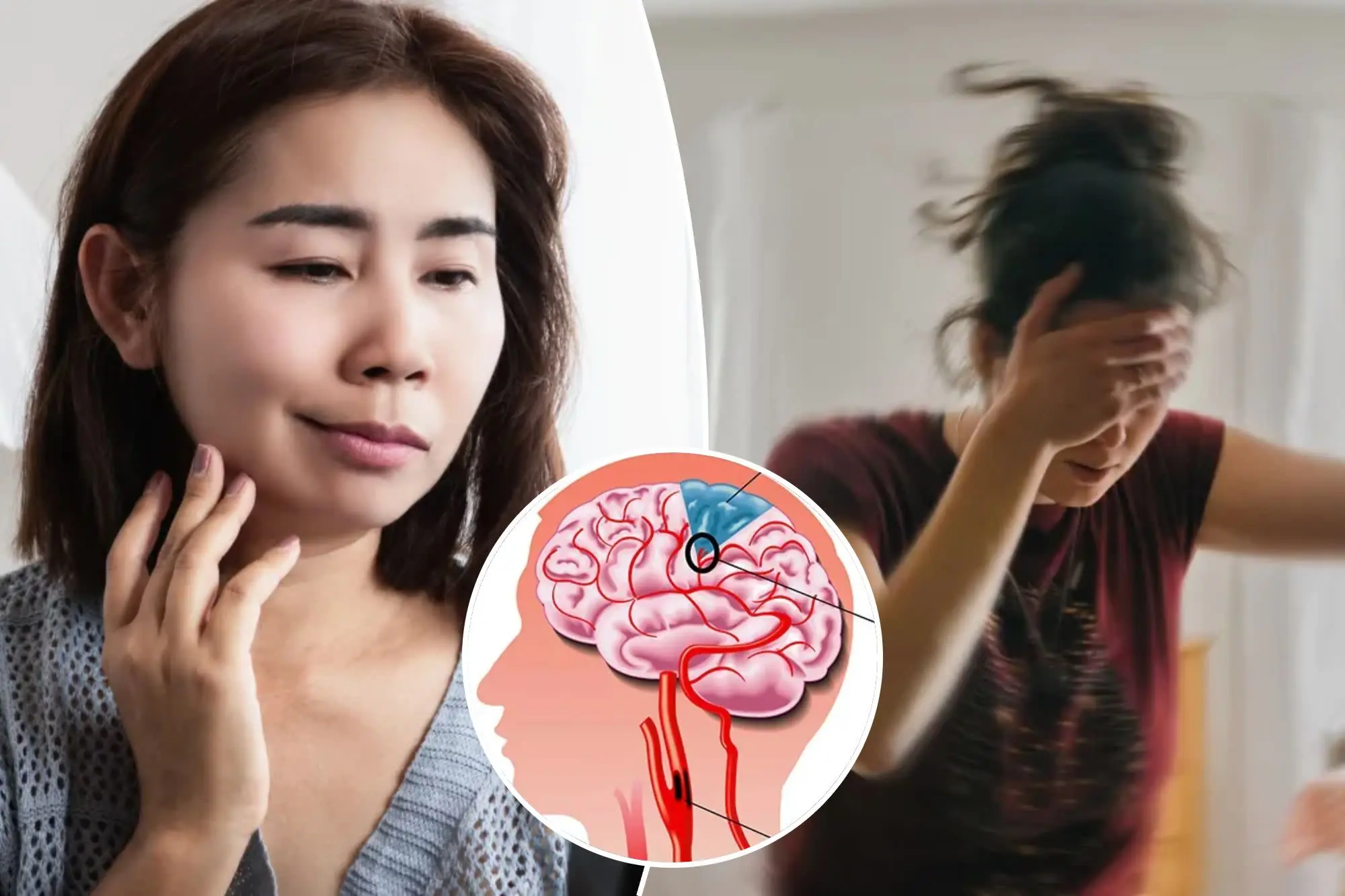 5 Stroke Warning Signs You Should Never Ignore — Acting Fast Can Save a Life