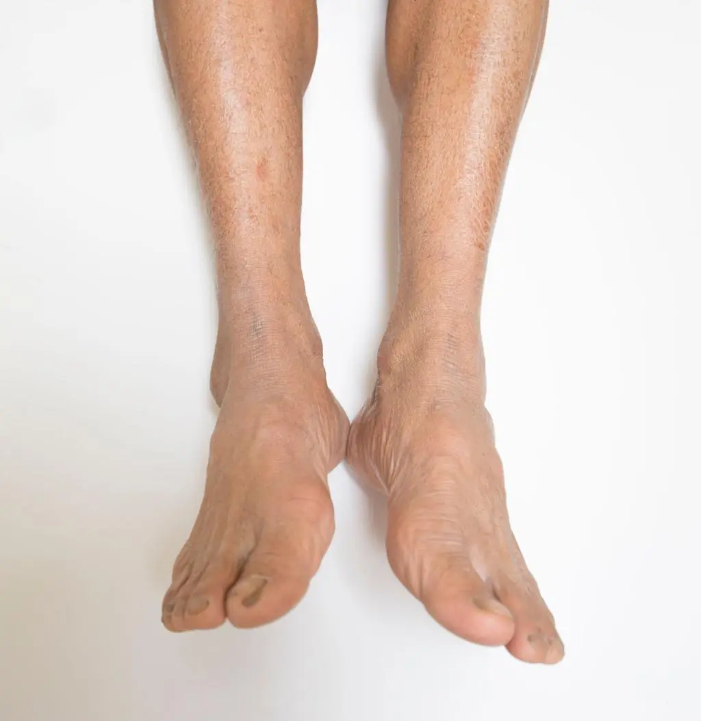 Plant-Based Protein and Aging: Can It Help Maintain Muscle Strength?