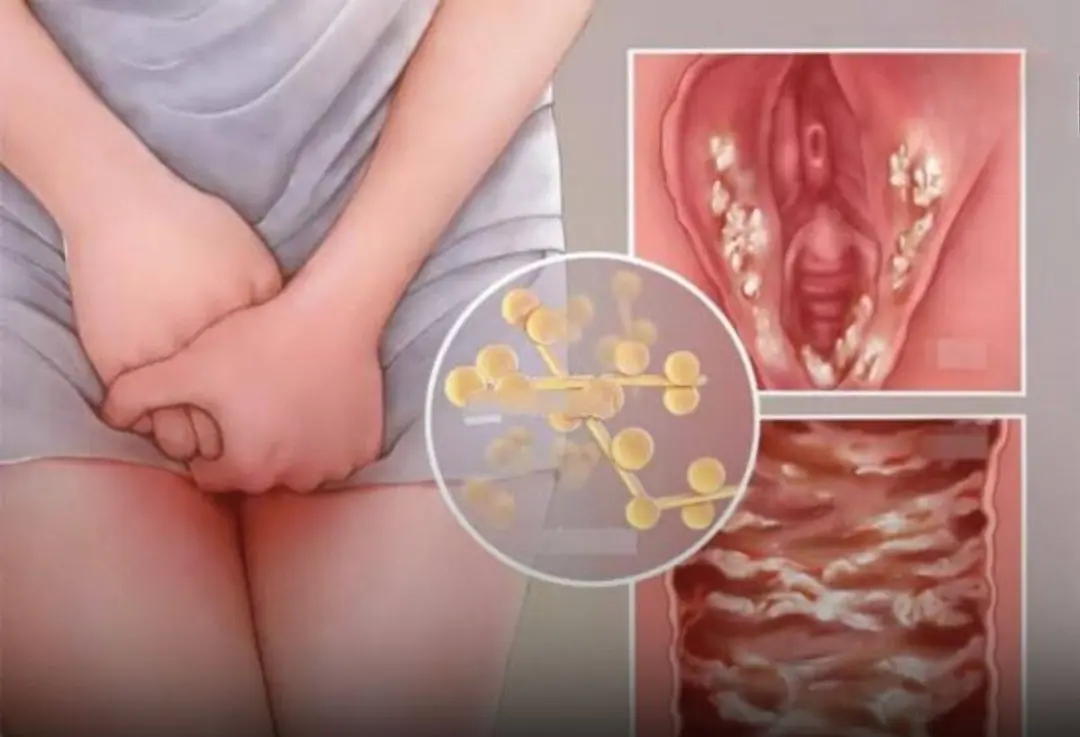 Common habits that could lead to hidden infections