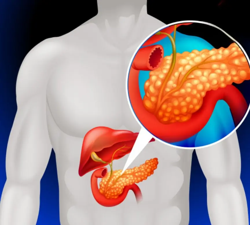 The Early Signs of Pan.creatic Can.cer Everyone Should Know