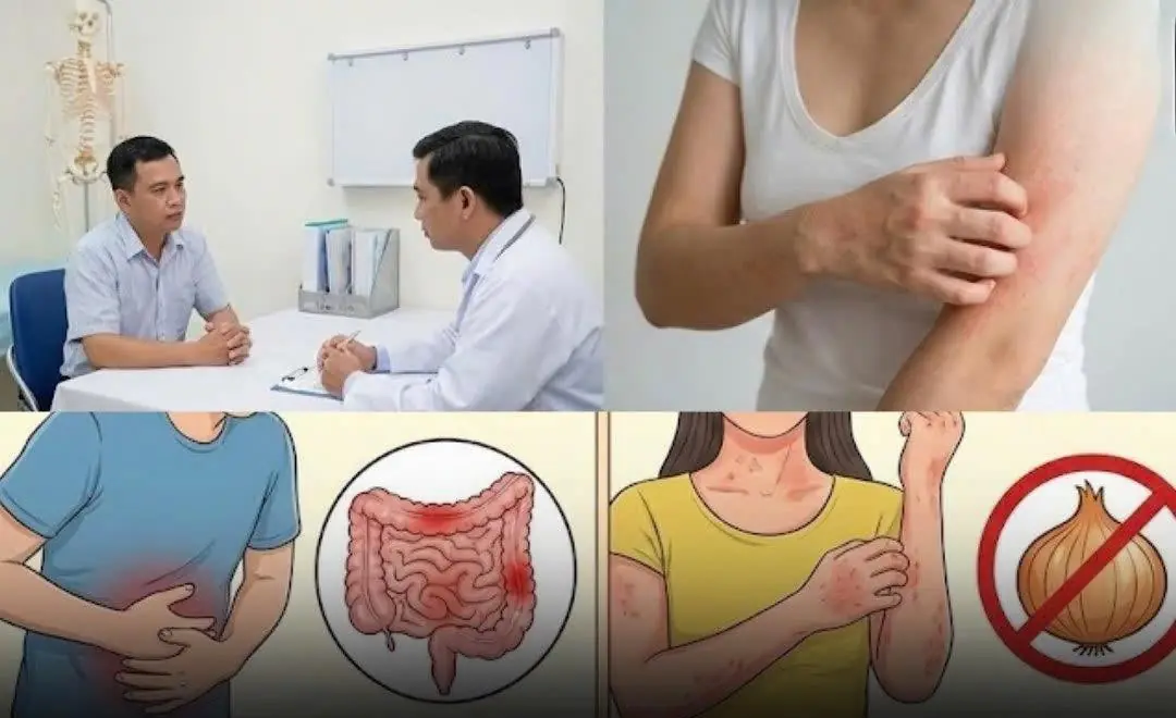 Not Everyone Should Eat Onions: Here’s Who Needs to Be Careful