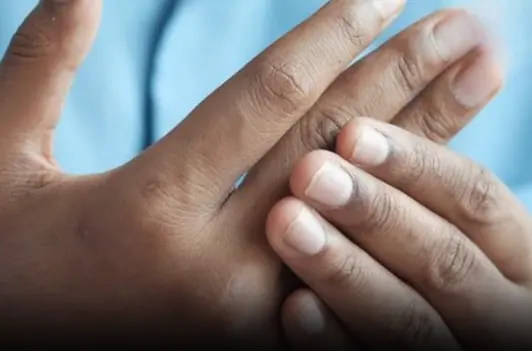 4 changes in fingers that could be signs of lung can.cer