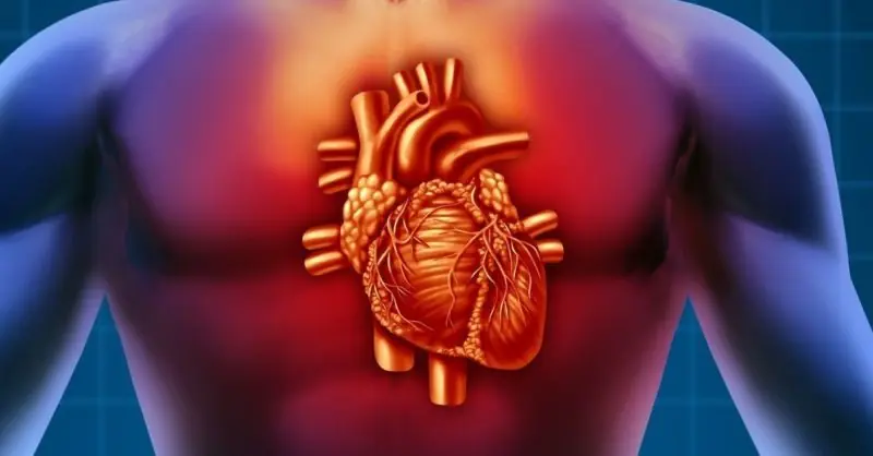 These 7 Early Signs Could Signal a Heart Attack—Especially Number 6