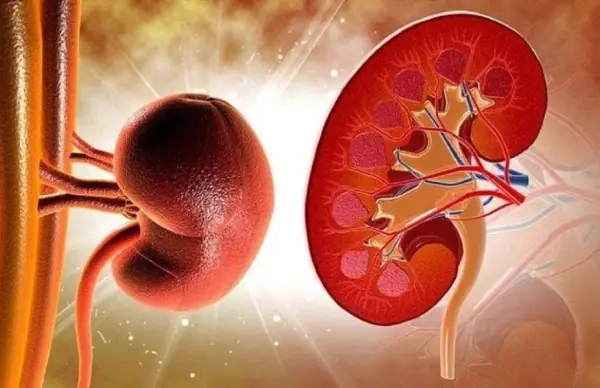 Waking up like this? It may be an early sign of a kidney issue—consider seeing a doctor