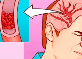 32 Symptoms That Could Indicate Low Magnesium Levels