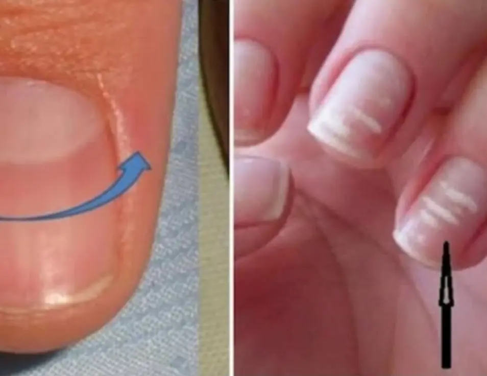 4 Warning Signs on Your Hands and Feet That Can be Early Signs of Can.cer—Don’t Ignore Them