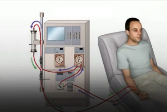 8 signs of kidney failure that if ignored may require lifelong dialysis