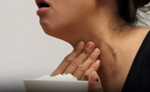 Suffering from a prolonged choking sensation, thought to be a stomach problem, the woman accidentally discovered that her thyroid gland had CAN.CER