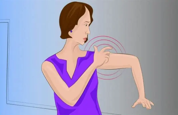 This “Mini Stroke” Could Be Your Body’s Early Warning — Especially After 40