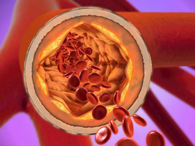 Doctors Warn: These 3 Morning Habits Can Worsen High Blo.od Pressure and Cholesterol