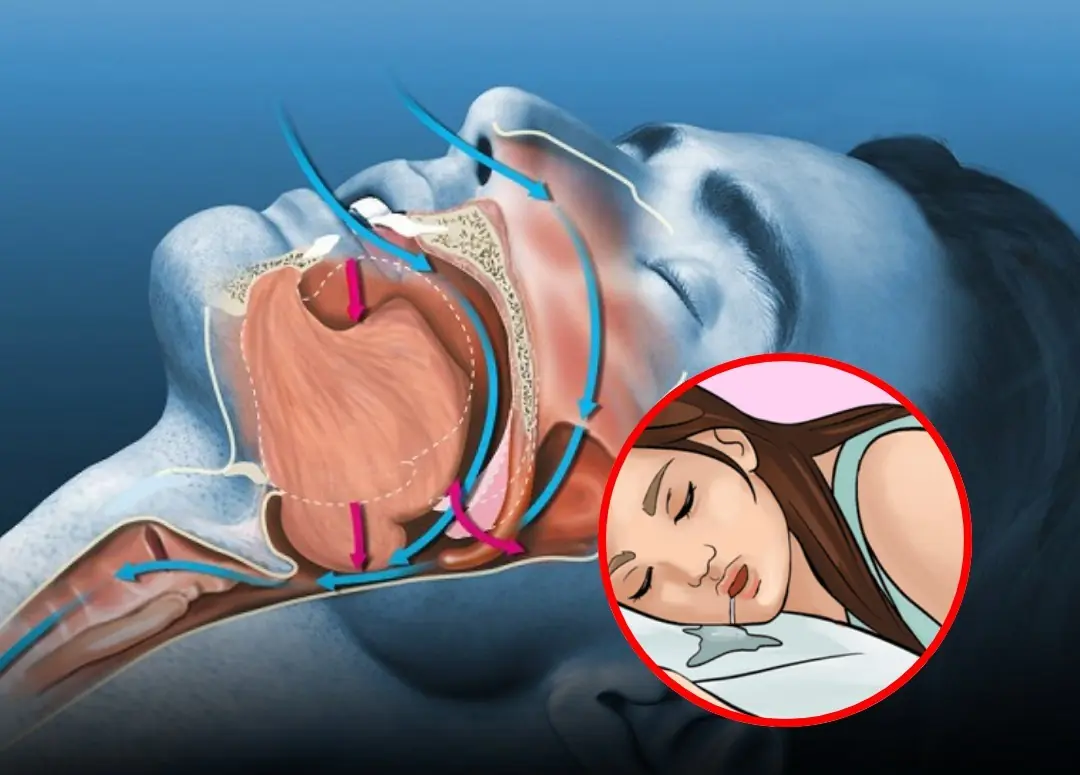 Why You Might Be Drooling in Your Sleep: 6 Common Reasons