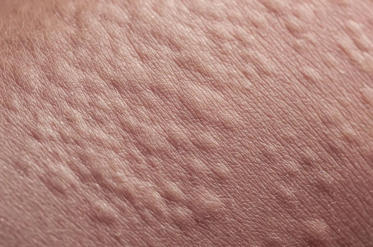 Itchy Skin Isn’t Always an Allergy: A Hidden Condition Revealed
