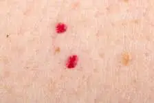 Red dots appearing on your skin out of nowhere? 😮 Don’t ignore this warning sign