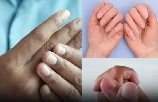4 changes in fingers that could be signs of lung can.cer