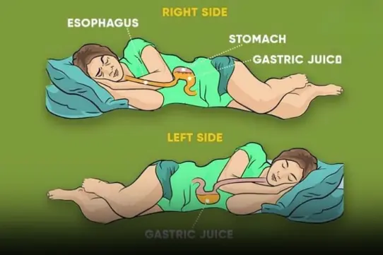 What sleeping on the left side