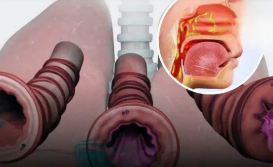 Recognizing mini-str.oke symptoms: A crucial step in str.oke prevention