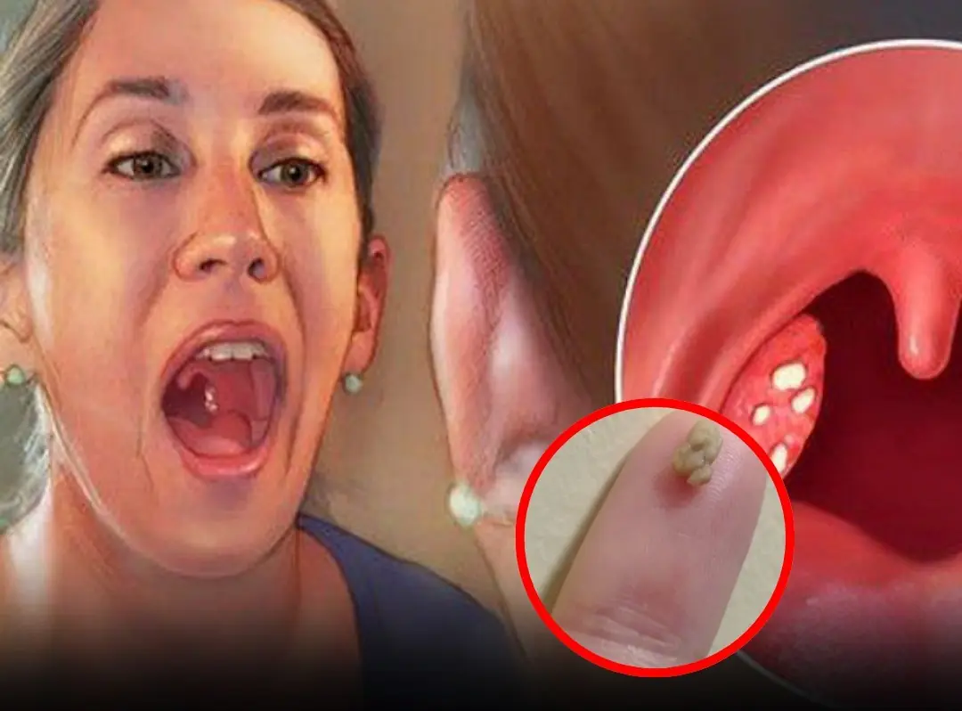 Noticing white bumps in your mouth? They could be related to underlying health issues.