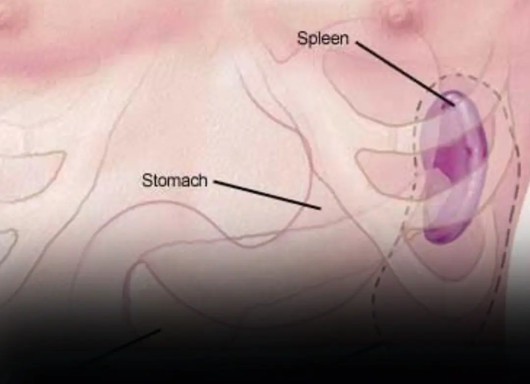 Could Your Spleen Be in Trouble? Watch for These Key Symptoms