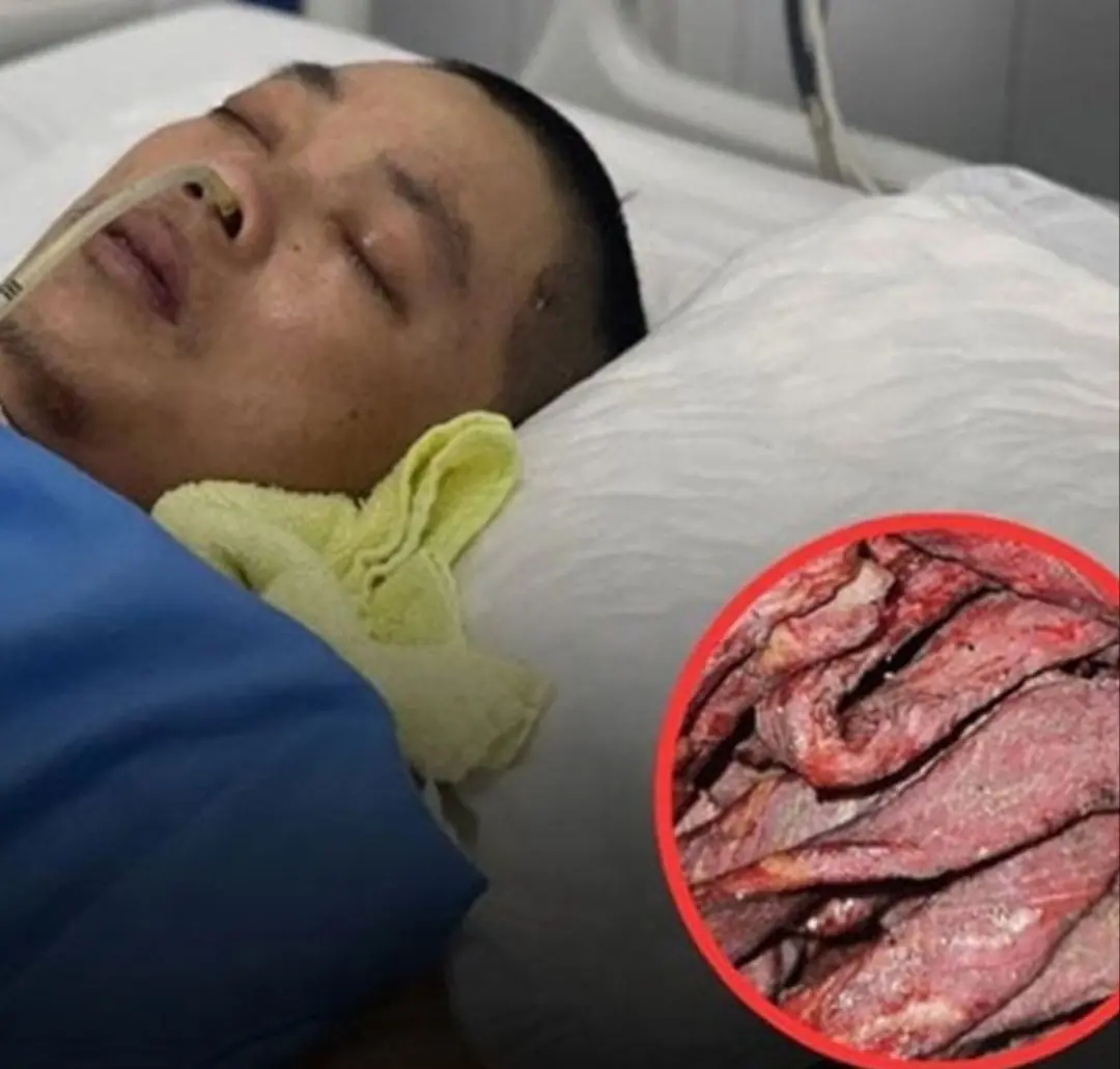 A type of meat that many people love and eat every day