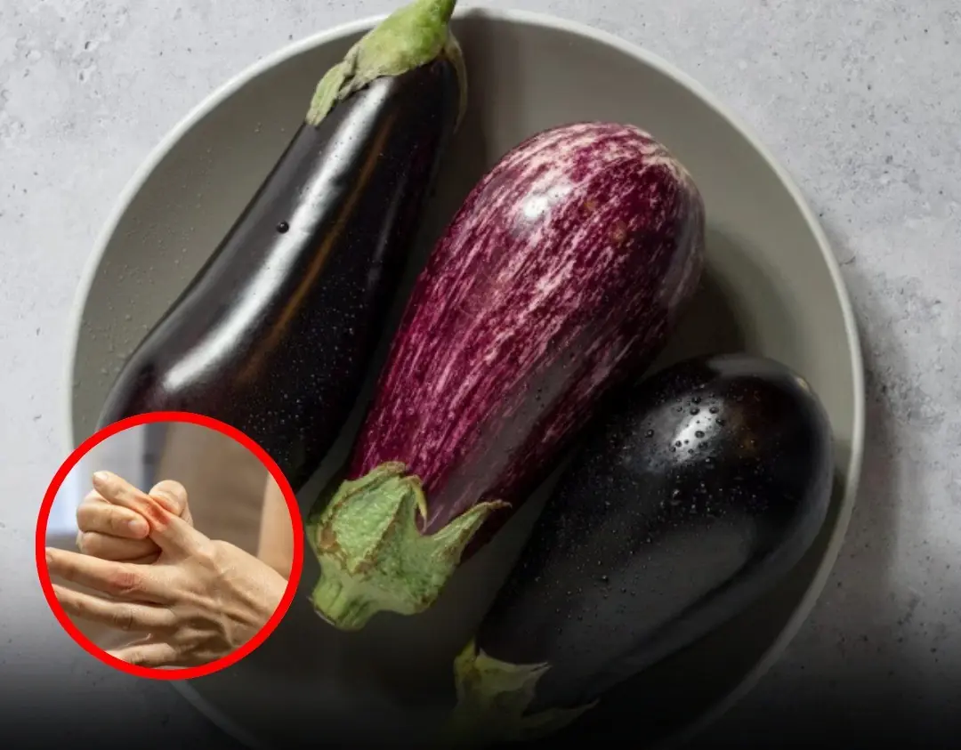 Potential Side Effects of Eggplant: 9 Groups That Should Limit Consumption