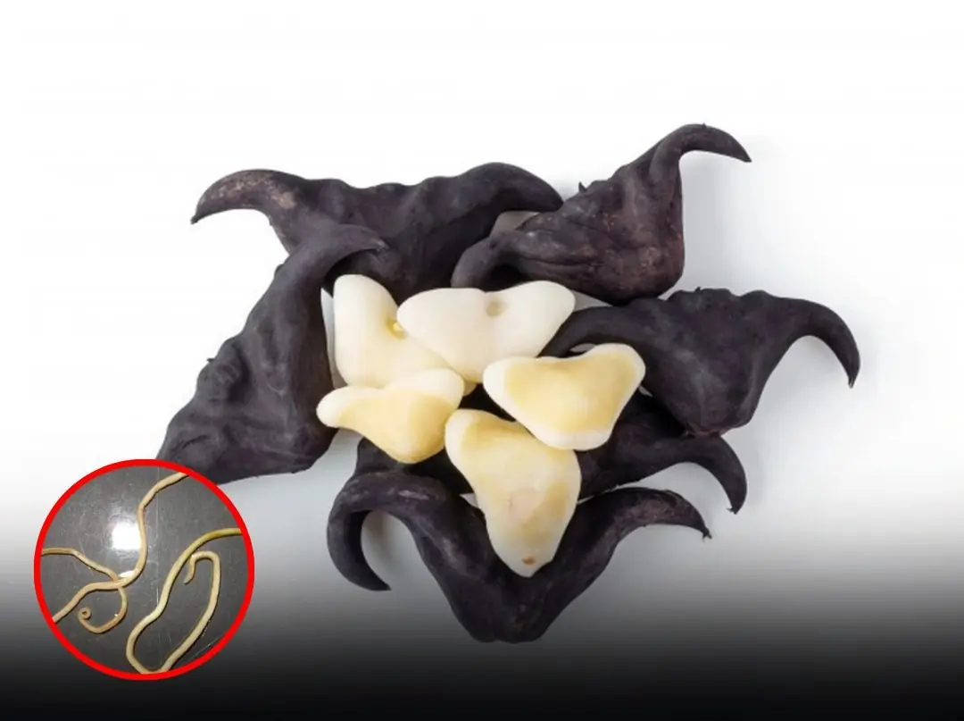 Before Eating Raw Vegetables, Know These 5 That May Carry Parasites