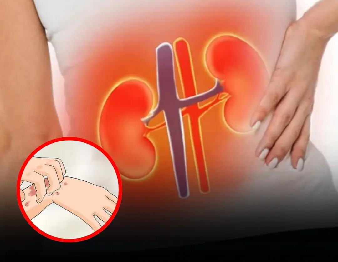 10 signs that your kidneys are failing and crying for help