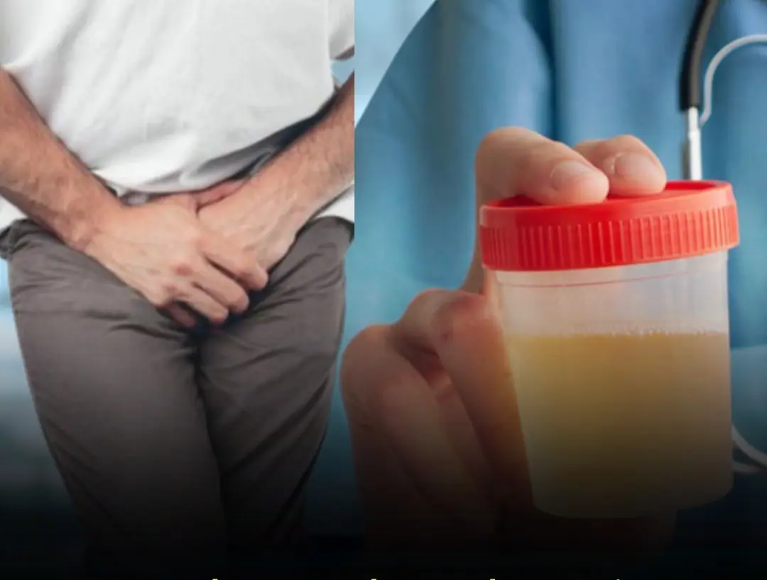 If You See These 3 Signs in Your Urine, Don’t Ignore Them — They Could Be Early Signs of Kidney Failure