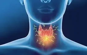 What types of foods can affect thyroid inflammation?
