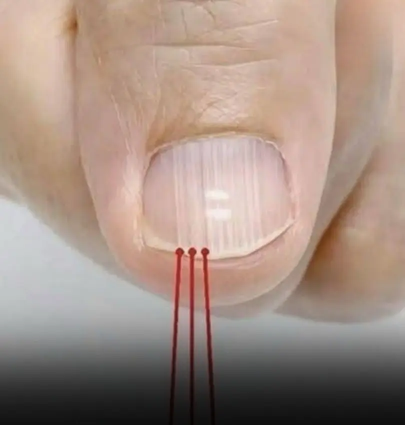 Most people panic when they see this—but the truth is surprising