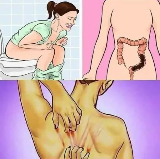 “20 Early Signs of Cancer” — Reality vs Viral Hype