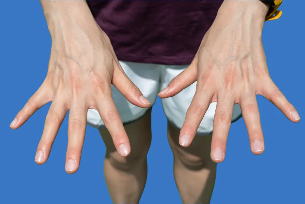 If You Have Visible Veins, Here’s What It Really Means About Your Body