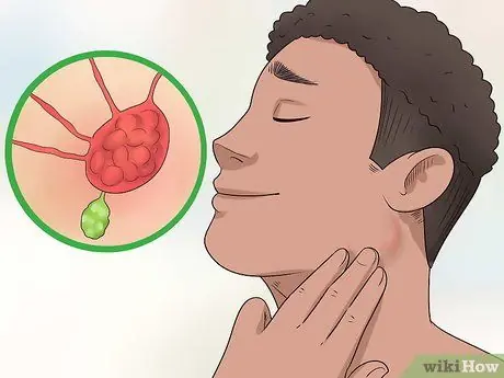 7 Warning Signs of Nasopharyngeal Cancer—The First Is Dangerous if Missed Early