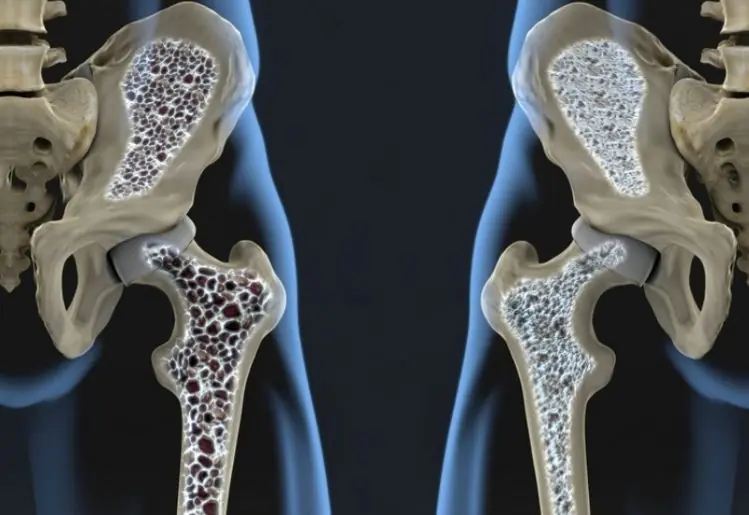 The 5 Drinks That Could Be Slowly Damaging Your Bones, According to Health Experts