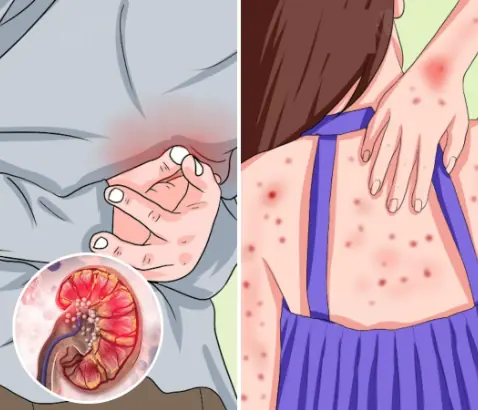 How your feet can indicate liver problems