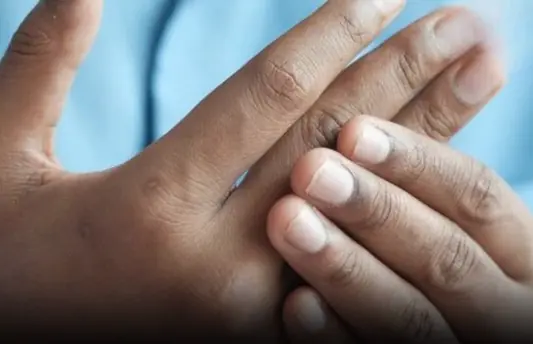 4 changes in fingers that could be signs of lung can.cer