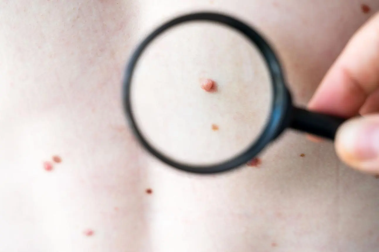 These 6 Warning Signs Often Appear Late—Ignoring Them Could Cost Precious Time