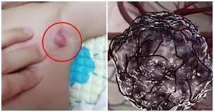 9 Early Warning Signs of Can.cer in Young Children — Parents Urged Not to Ignore