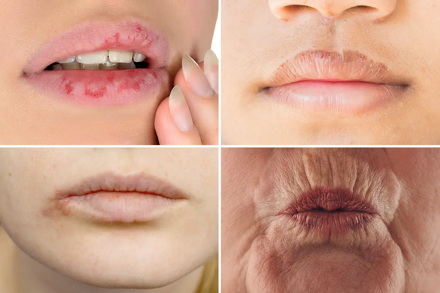 Strange Changes on Your Lips? It Could Be a Warning Sign of Hidden Health Issues