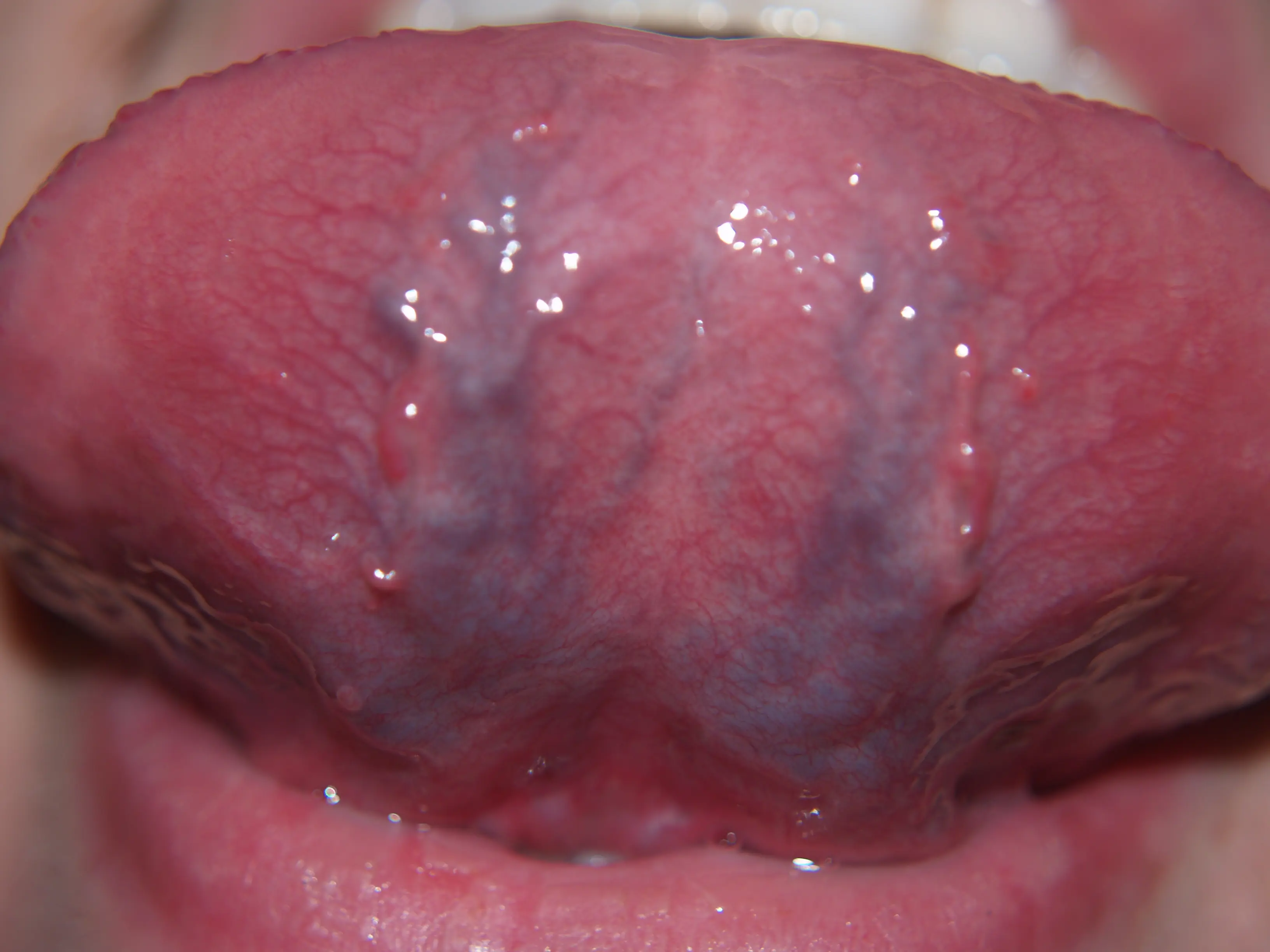 A Purple Vein Under Your Tongue? Here’s What Your Body May Be Trying to Tell You