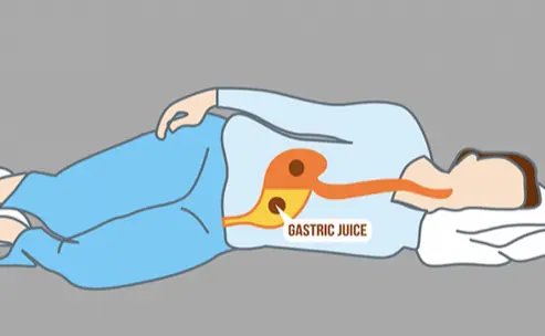 Right-side sleepers, pay attention—this could surprise you