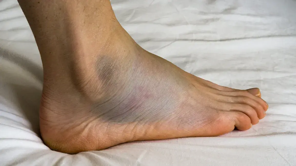 Swollen Feet? Here’s the Hidden Message Your Body May Be Trying to Send