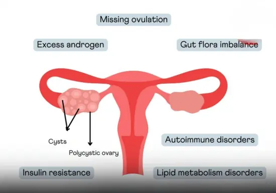 Eat 6 things to help women detoxify their ovaries and prevent gynecological diseases