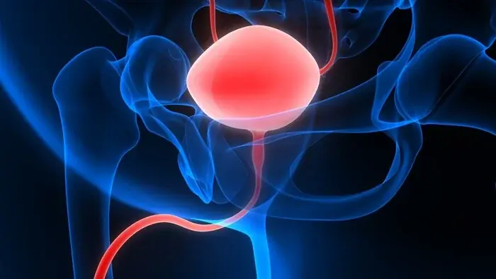 What are the early warning signs of bladder can.cer that are easy to miss?