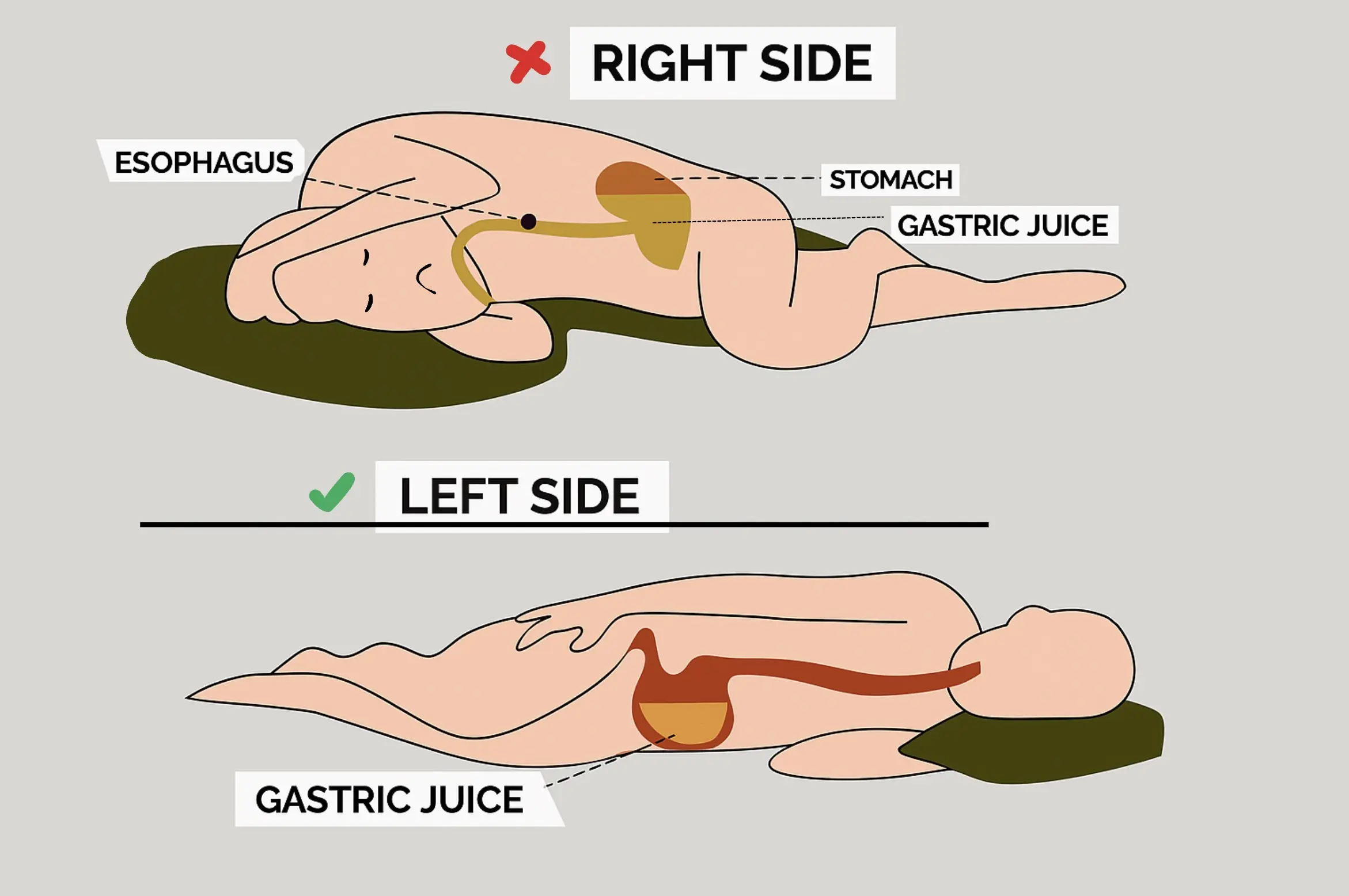 Sleeping on Your Left Side: A Simple Habit With Surprising Health Benefits