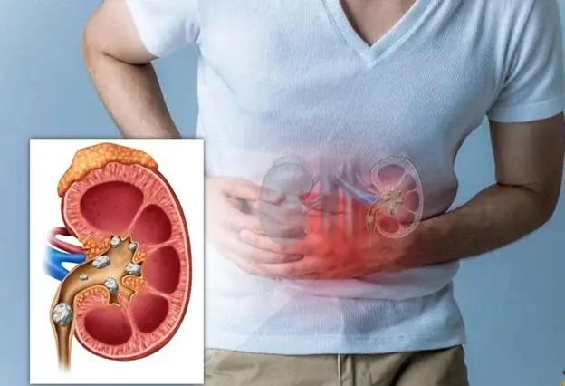 Signs your kidneys may not be functioning well – what to watch for