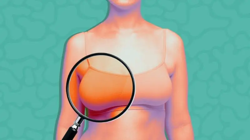 The First Signals Are Subtle: Breast Cancer Symptoms That May Appear a Year Earlier