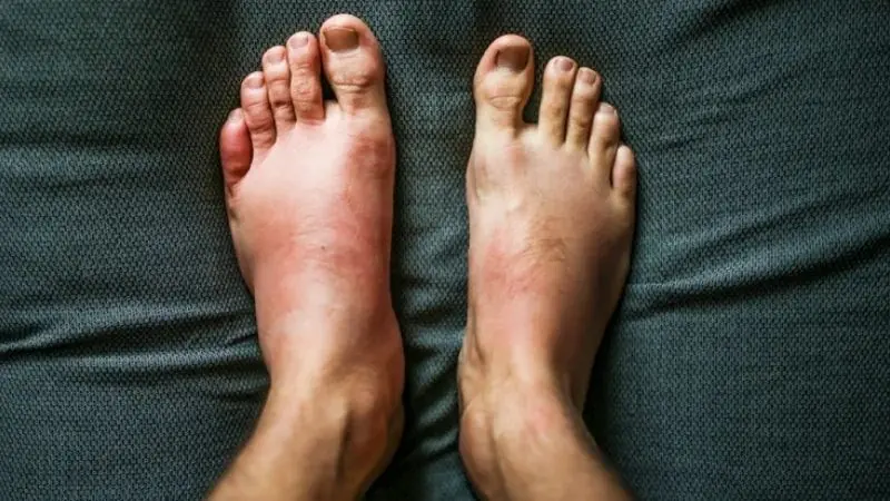 Swo.llen hands and feet: What your body may be trying to tell you?