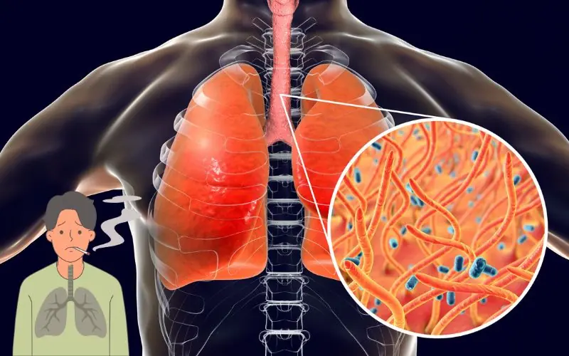 8 Simple Ways to Get Rid of Phlegm and Mucus in the Chest and Throat