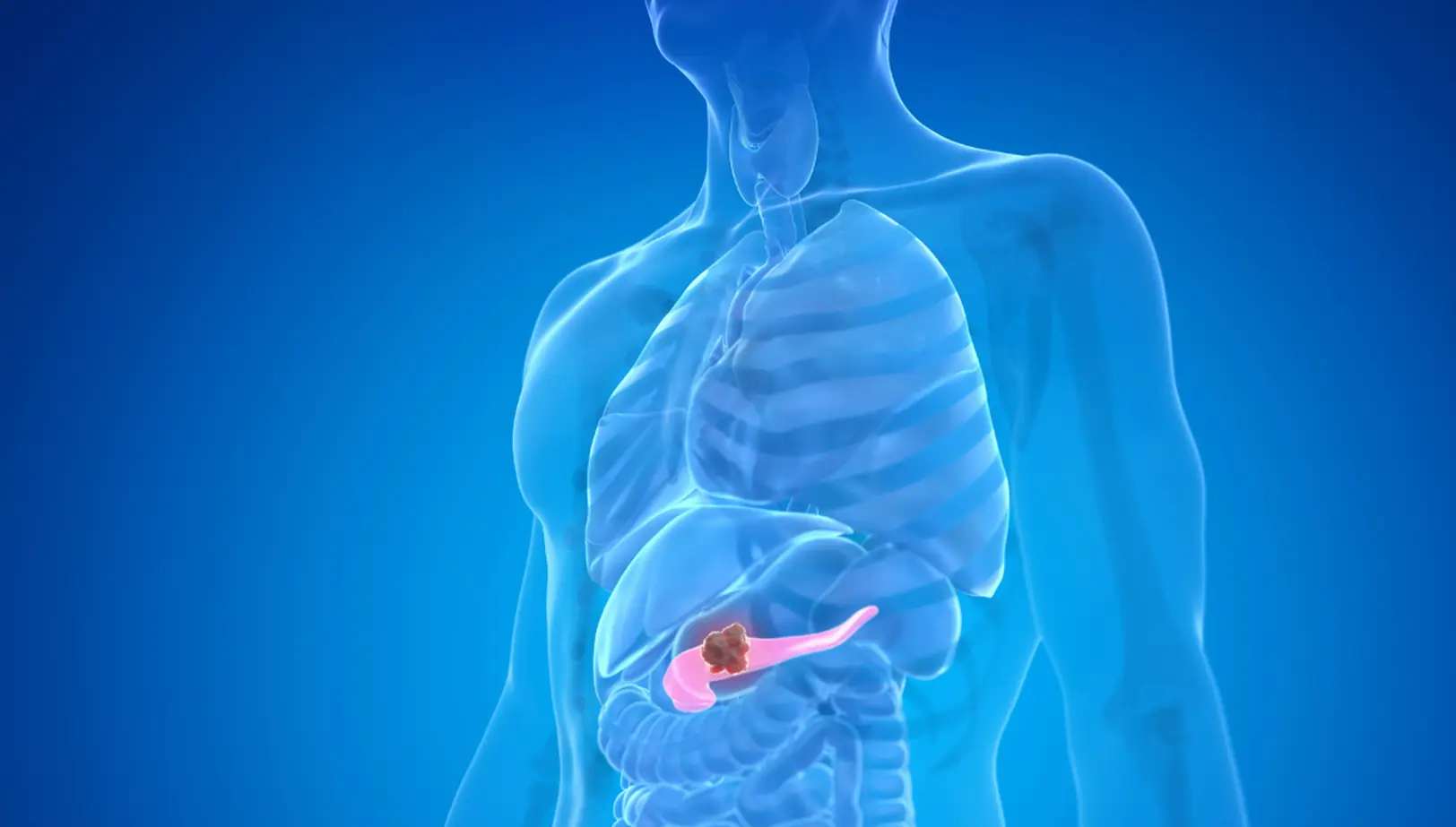 Pancreatic Can.cer: 10 Early Warning Signs You Should Never Ignore